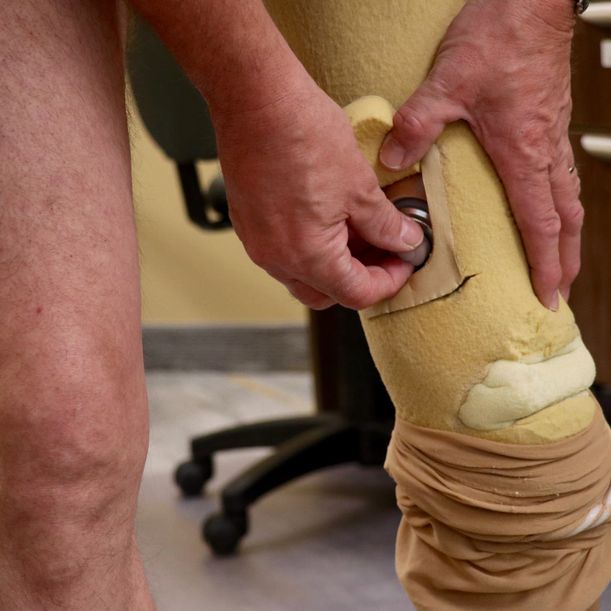 custom made prosthetic
